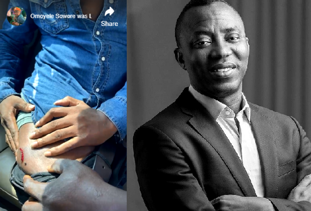 How Sowore was Shot by Policeman During Protest in Abuja 2 sowore-shot-during-protest-rally-at-abuja