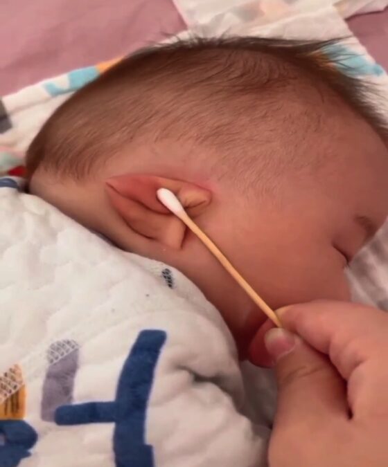 Video-Baby With The Ability To Fold His Ear Shut Does not Like Anything Touching It Even An Ear Cleaning Cotton Swab Bud